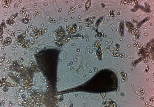IBM's AI Microscopes Use Plankton As Living Water Sensors