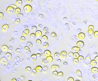 Exposure to Fracking Chemicals and Wastewater Spurs Fat Cells