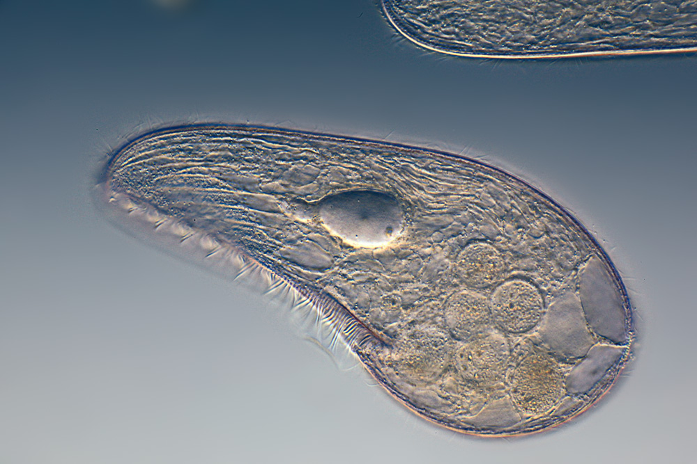 Researchers Detect Protozoa in Drinking Water