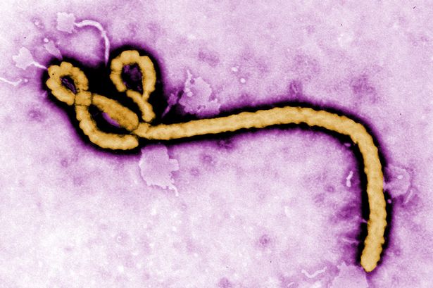 Ebola Able to Survive in Sterilized Wastewater, Study Says