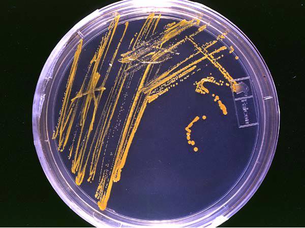 The Need for Speed – Rapid Evolution of Microbiological Testing in Drinking Water