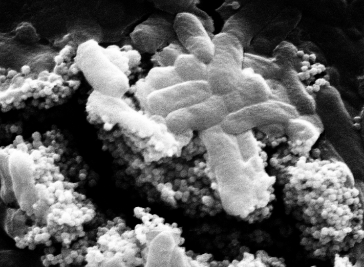 Phage-enhanced ​Nanoparticles ​to Kill ​Bacteria