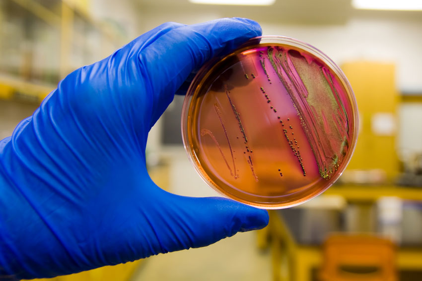 Clean Water-treatment Option to Target Sporadic Outbreaks