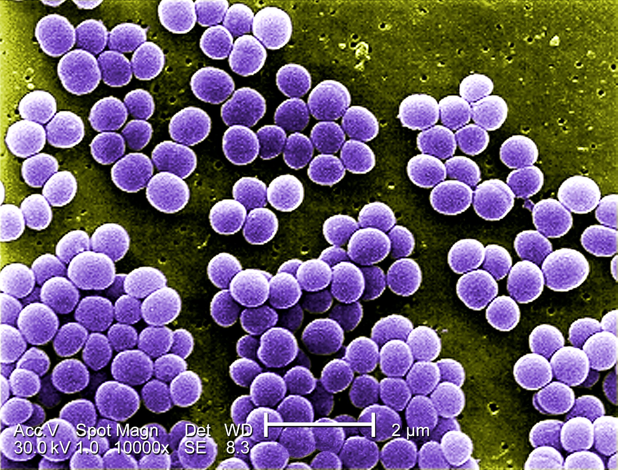 Bacteria to Remove Metals From Mine-Impacted Water