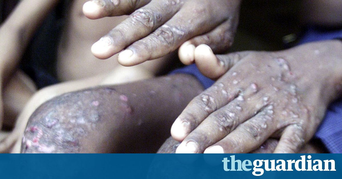 How to Protect 20 Million from the World's Largest Poisoning