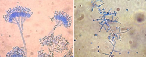 Filamentous Fungi in Drinking Water, Particularly in Relation to Biofilm Formation – ScienceOpen