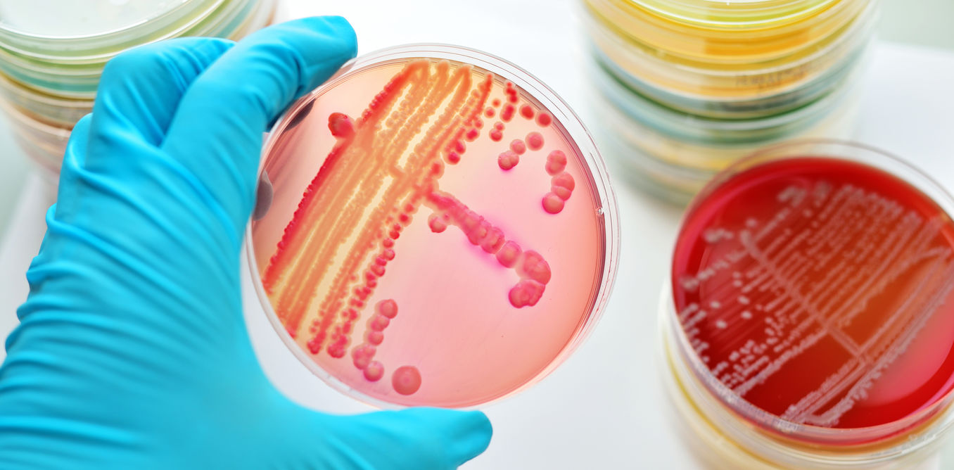 Superbugs evolve in waste water, and could end up in our food