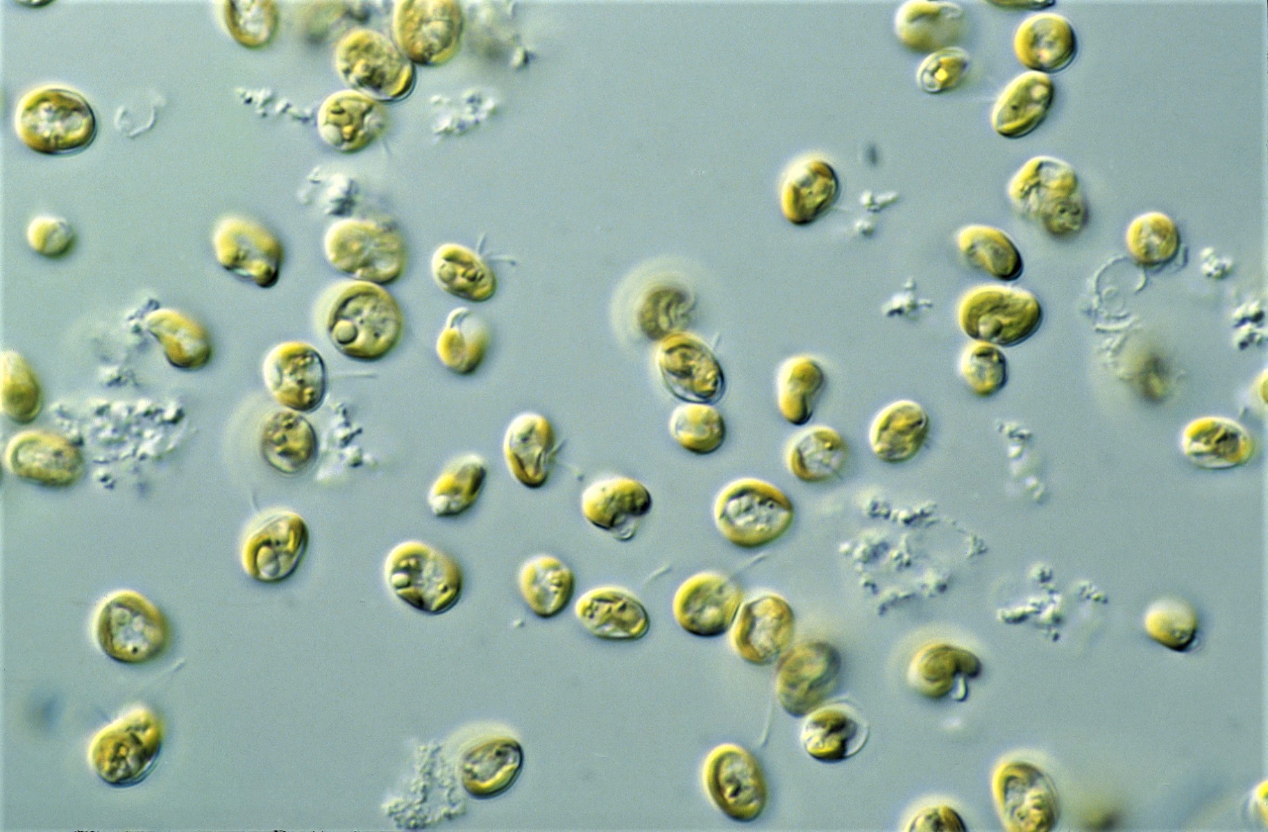 Production Of Microalgal Biomass Using Wastewater Reduces Antibiotic Resistance To Environment