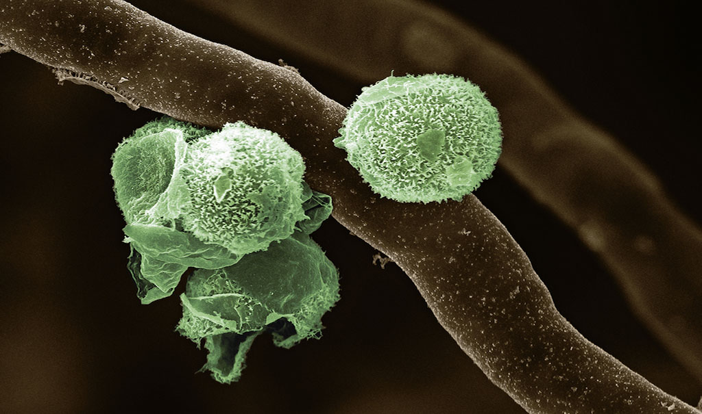 Algae Living Inside Fungi: How Land Plants First Evolved