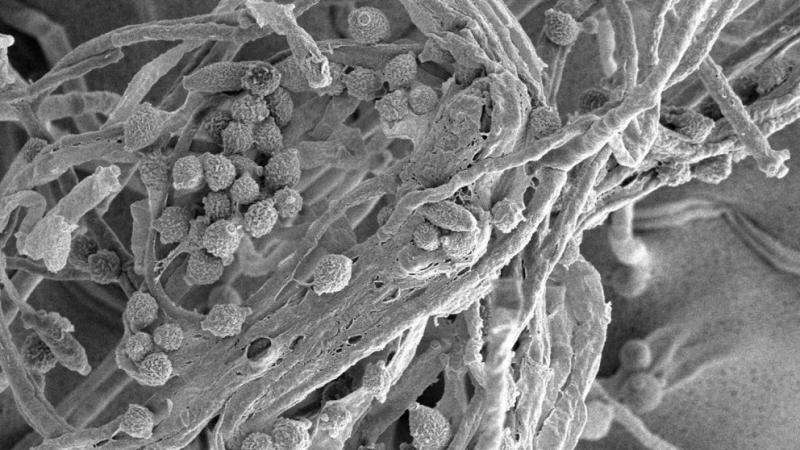 Manganese Oxides in Treatment System