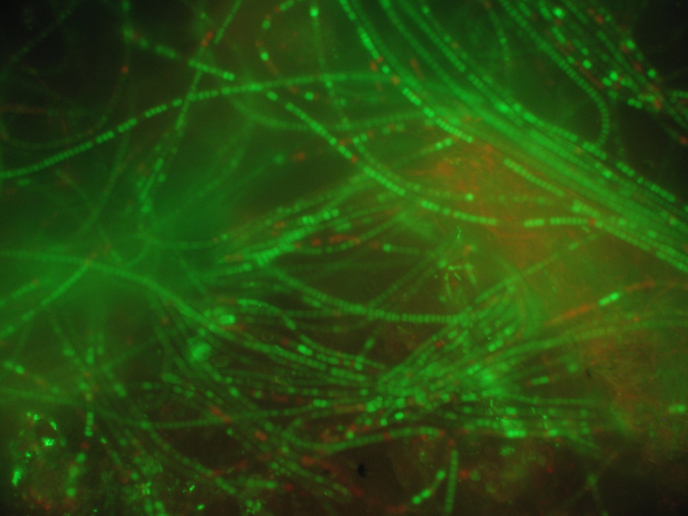 high level microscopic sludge examination, incl. epifluorescence microscopy