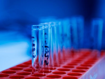 Automated Microbiology System Receives US EPA Approval 