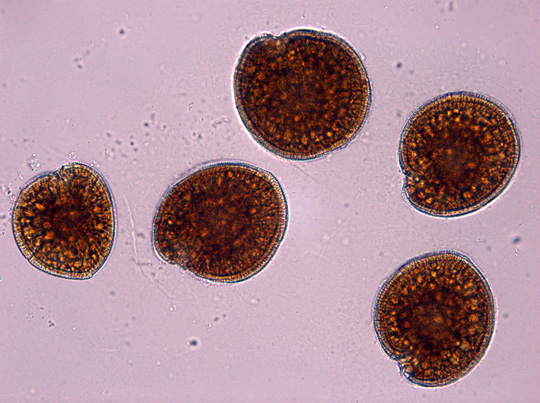 Gambierdiscus Toxins Increasing by 60%