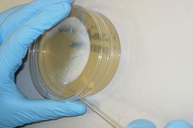 Sewage Treatment Seen As Barrier To Rising Antibiotic Resistance