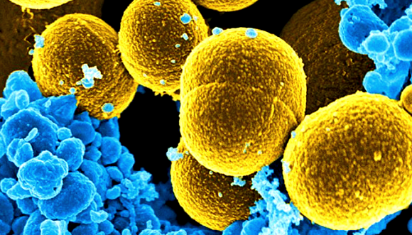 Army of Bacteria Against Polluted Wastewater