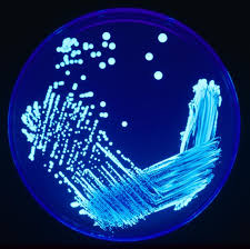 Hospital's Legionella Counts Reduced to Non-Detect with Flow-Tech Systems Technology