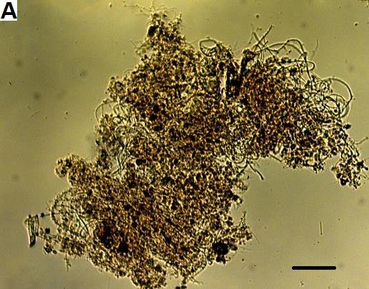 **Part 8: Bioindicators for Early Detection of Operational Issues**Using Protozoan Analysis and the Sludge Biotic Index (SBI)*1. **Balanced *Vor...