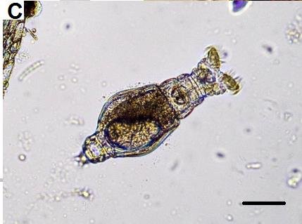 Part 9: Challenges and Opportunities in Using Bioindicators for Wastewater TreatmentData Limitations:Although protozoan analysis and the Sludge ...