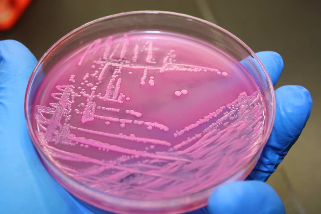 Coliform Bacteria in Water Wells