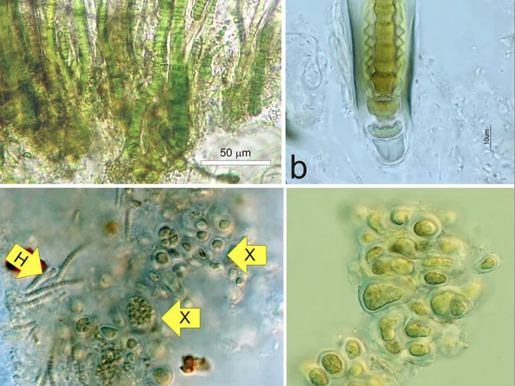 Algae-based wastewater treatment & reuse technology