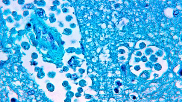 Deadly Amoeba Found for the First Time In Municipal Water Supply