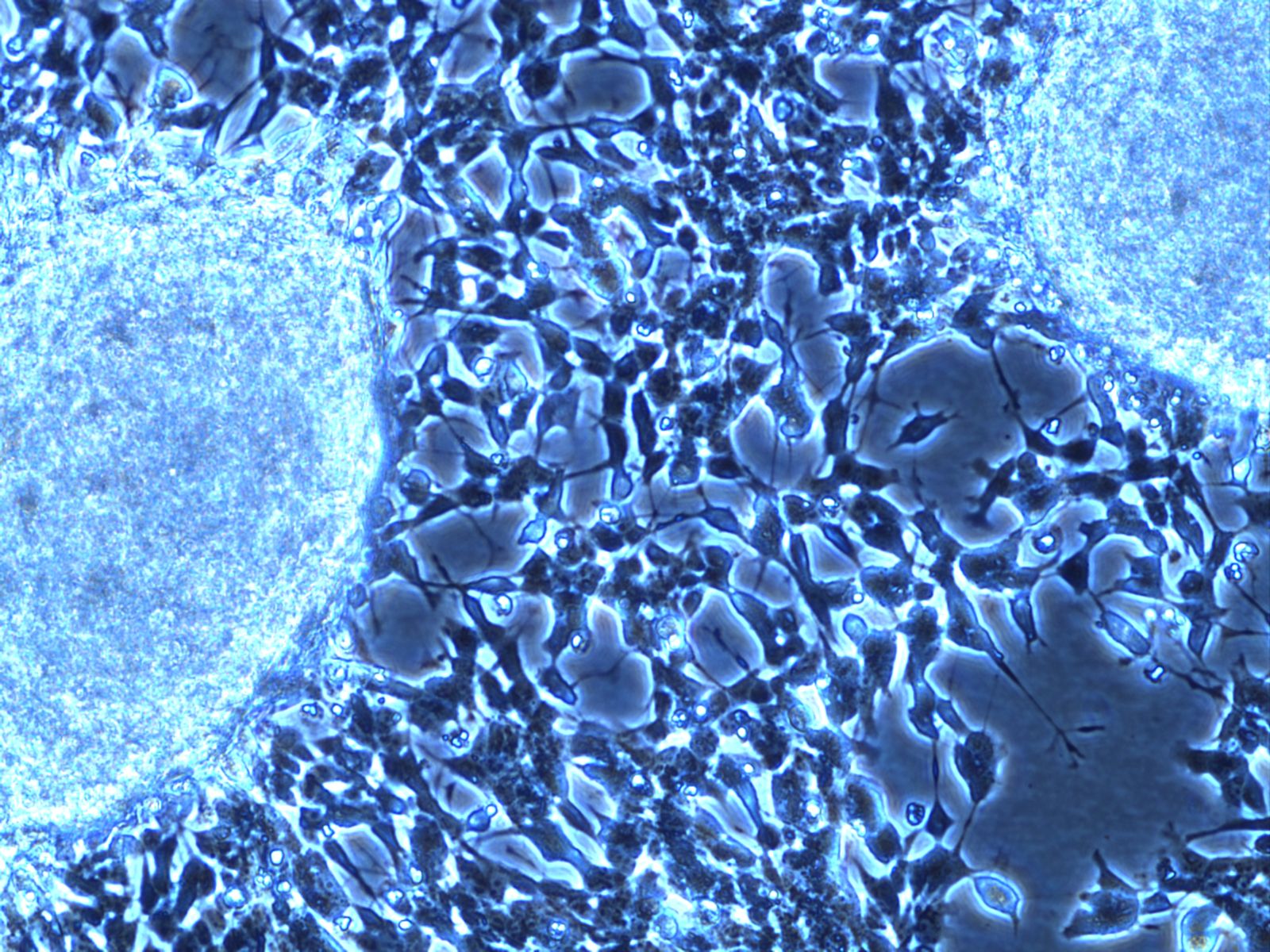 European Union Releases Criteria to Identify Endocrine Disruptors
