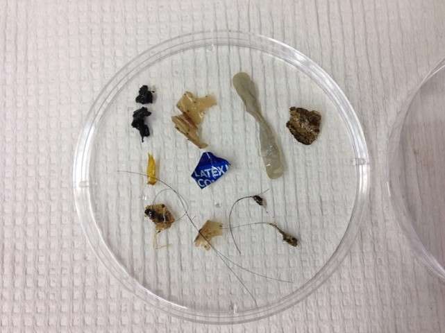 Wastewater Treatment Plants Significant Source of Microplastics in Rivers