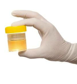 Researchers Partner with Brewery to Collect Urine and Generate Fertilizer
