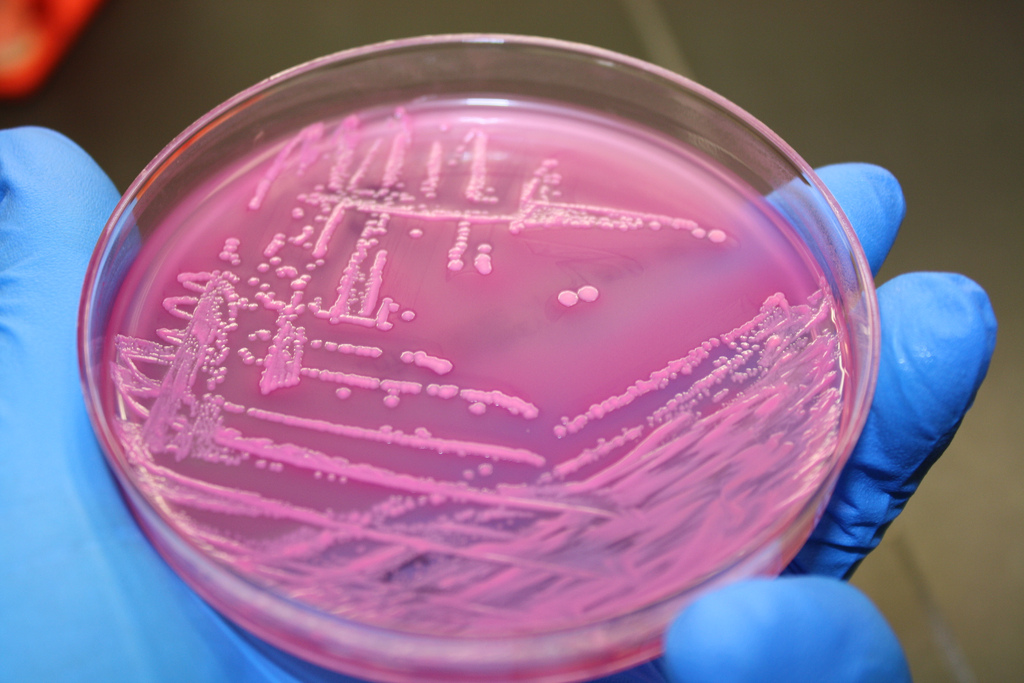 Coliform Bacteria in Water Wells - The Water Network | by AquaSPE