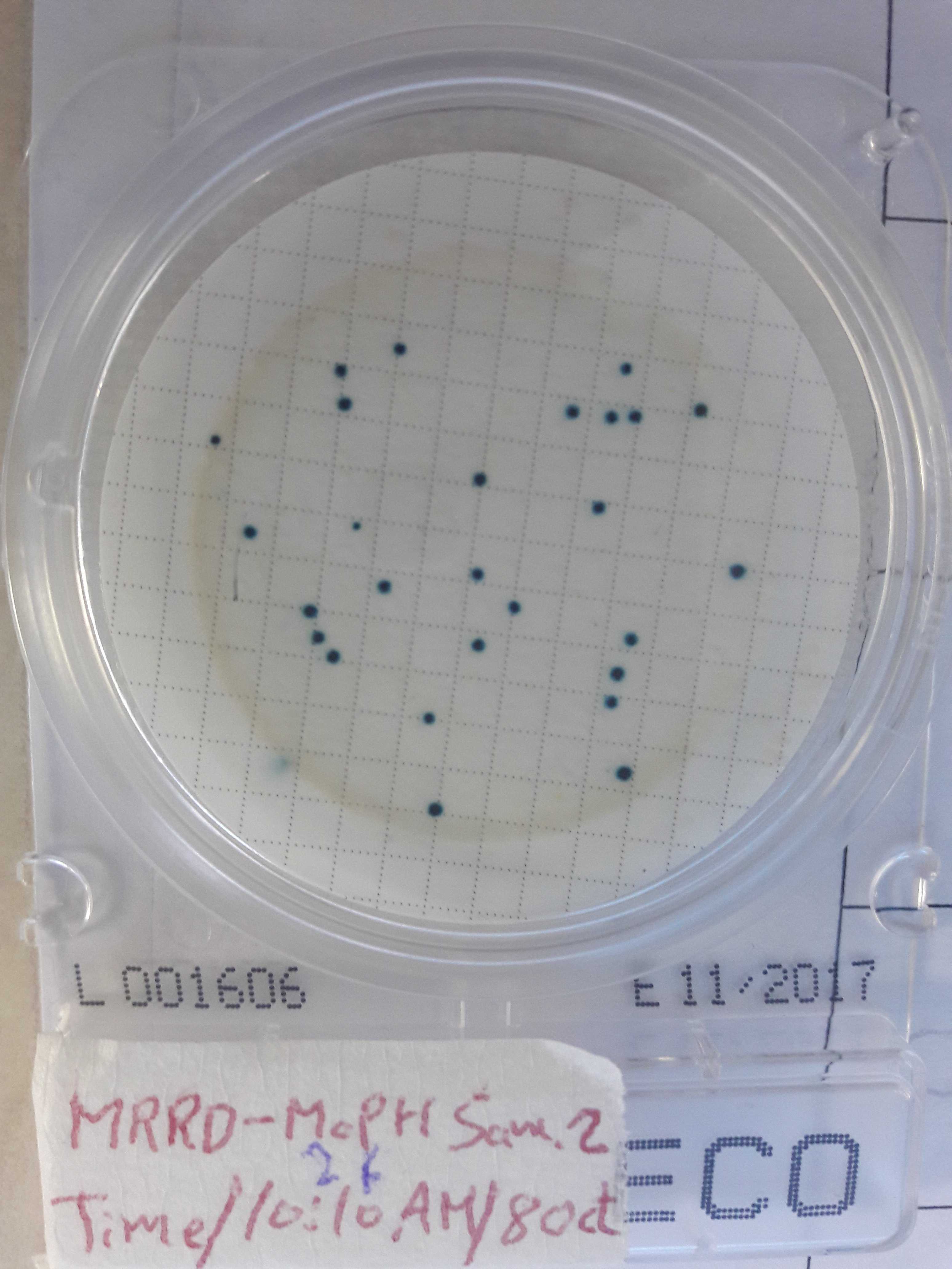 Presence of  E. coli  in ...