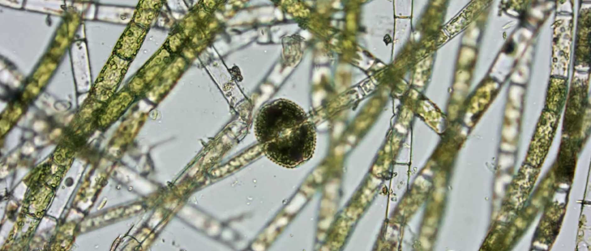 Cyanobacteria's game of blooms: fast track or endurance run?