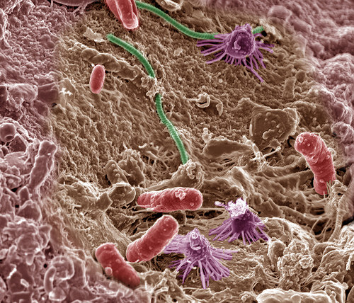Soil Microbes May Not Be Adaptable to Climate Change