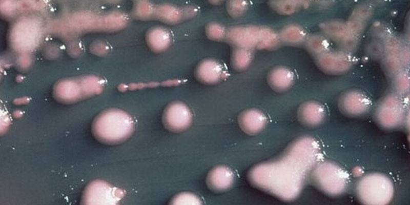 New Sensor Device Spots Bacteria in Food and Water Fast